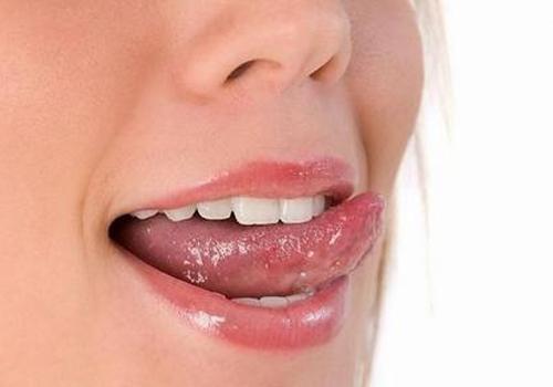 舌头溃疡怎么止疼 舌头溃疡的中药偏方